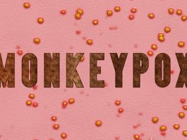 Monkeypox 7252405 640 265x198